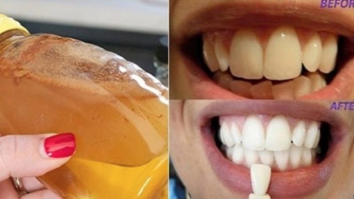 Evde Kendiniz Bu Doğal Yöntemle Dişlerinizi Bembeyaz Yapabilirsiniz Hem de Sadece Her Evde Bulunan 3 Malzeme ile