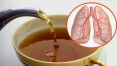 Bu Doğal Çayı İçerek Akciğerlerinizi İyileştirin: Öksürük, Astım, Bronşit, Romatizma, Enfeksiyonlar …