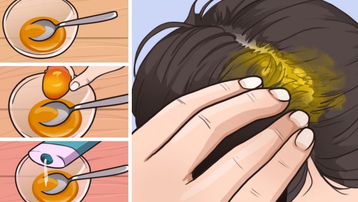 Saç Dökülmesini Önlemek Ve Saçı Gürleştirmek İçin Evde Bu Bitkisel Yöntemleri Uygulayın